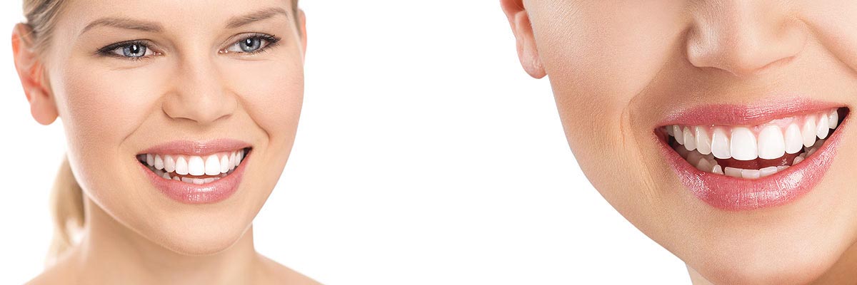 Santa Cruz Cosmetic Dental Care