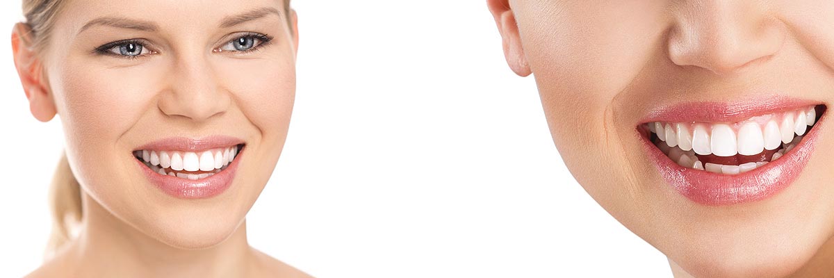 Santa Cruz Cosmetic Dental Services