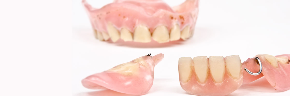 Santa Cruz What Do I Do If I Damage My Dentures?