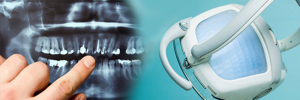 Santa Cruz Dental Cleaning
