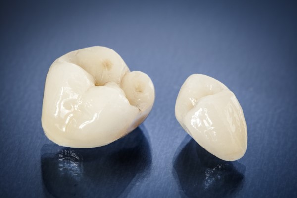 Reasons Why A Dentist May Recommend A Dental Crown