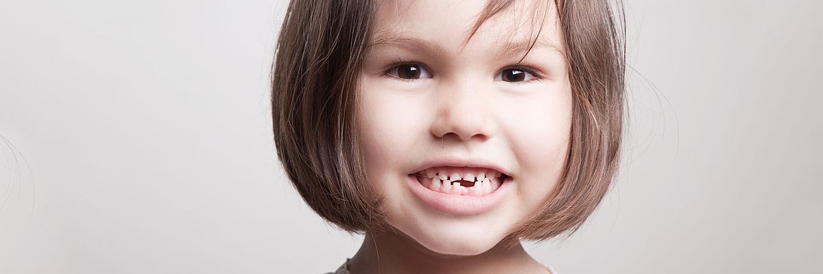 Santa Cruz Dental Restoration