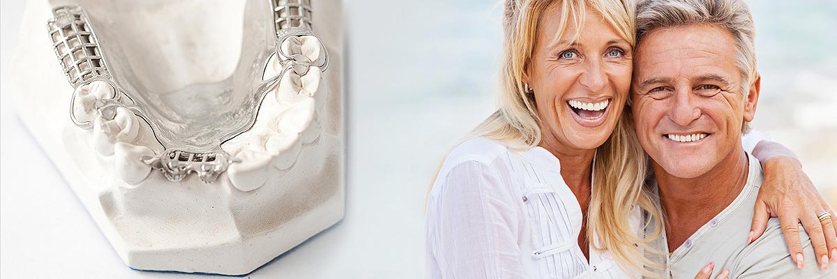 Santa Cruz Implant Supported Dentures