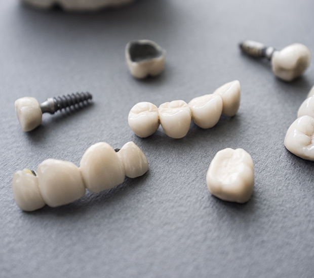 Santa Cruz The Difference Between Dental Implants and Mini Dental Implants