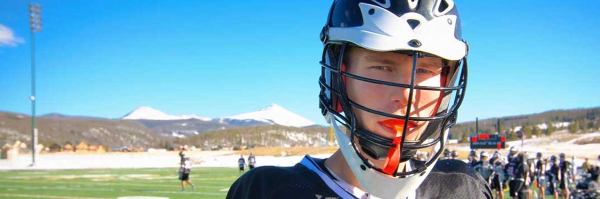 Santa Cruz Mouth Guards