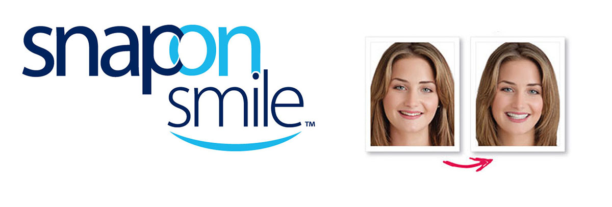 Santa Cruz Snap-On Smile