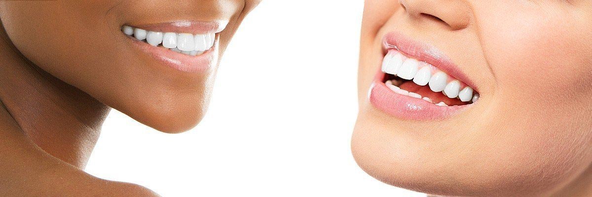 Santa Cruz Dental Restoration