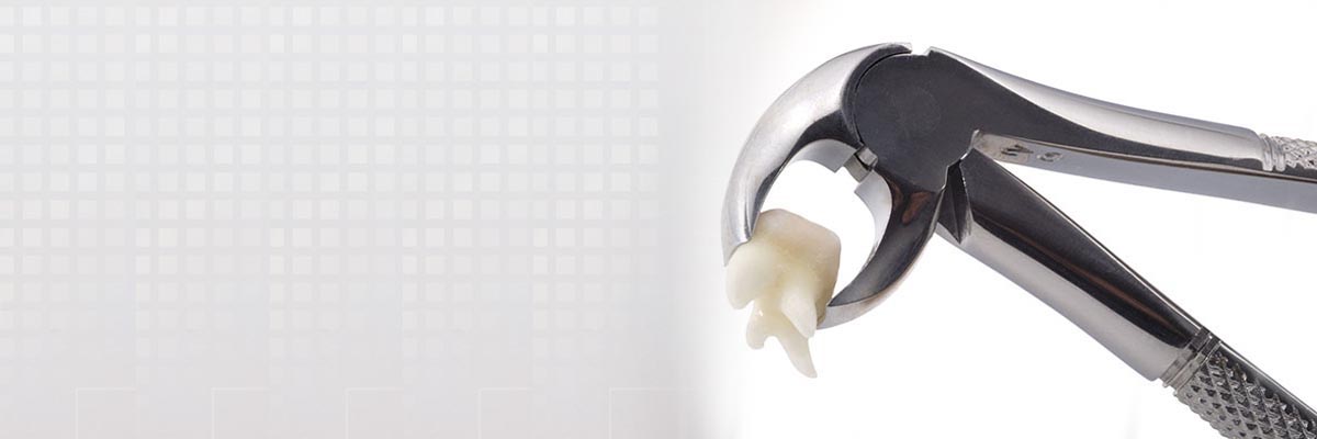 Santa Cruz Tooth Extraction